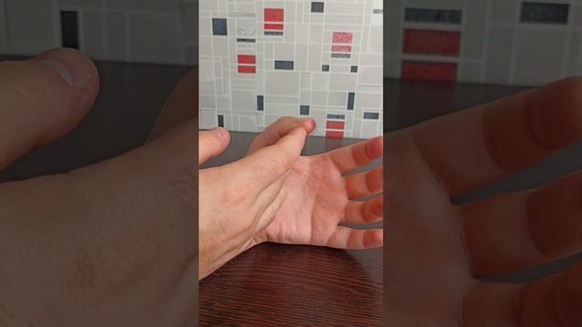 Как избавиться от ожога паяльником. Последствия ожога смотреть онлайн