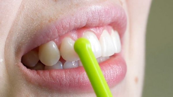 Обучение ITOP - как сохранить свое стоматологическое здоровье навсегда