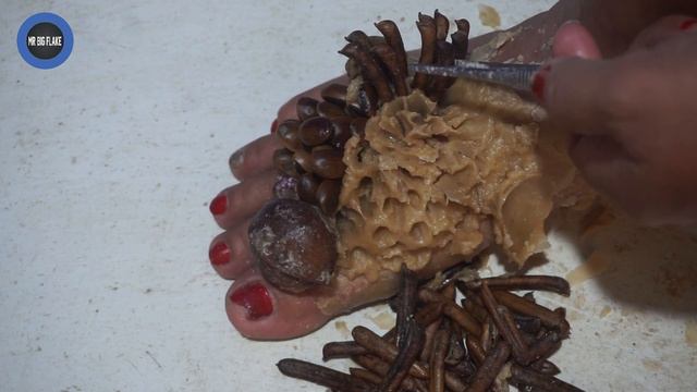 WOW!! Dandruff Cleaning Worms #700