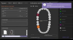 25. Алгоритм подгрузки аксиографии в «Экзокад».