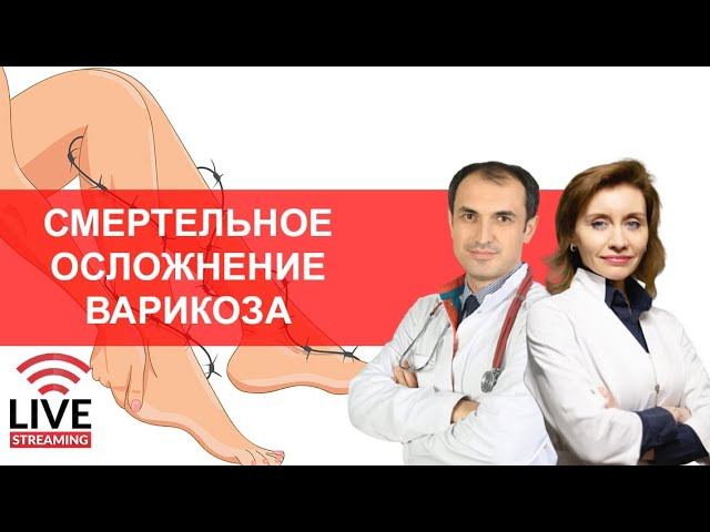 Смертельное осложнение варикоза. Прямой эфир смотреть онлайн
