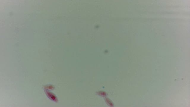 Эвглена Euglena смотреть онлайн