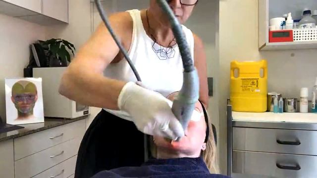 Cutera Laser Treatment for Sensitive Skin and Rosacea смотреть онлайн