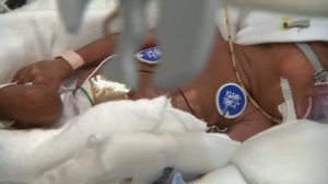 ПОРОК СЕРДЦА У РЕБЁНКА: ПРИЧИНЫ, СИМПТОМЫ И ЛЕЧЕНИЕ