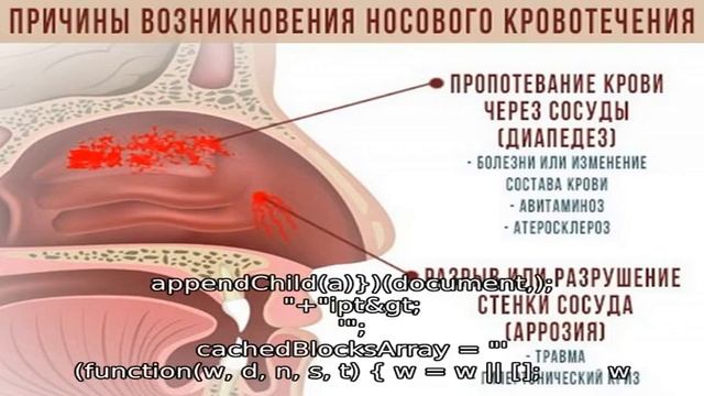 Почему у ребенка неприятно пахнет из носа и что делать в этой ситуации? смотреть онлайн