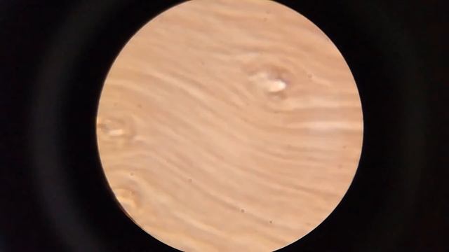 Кровь после свеклы. Что изменится? смотреть онлайн