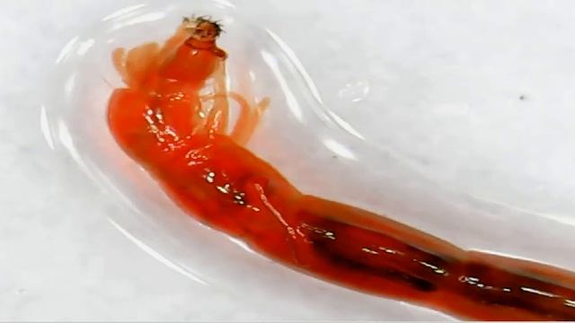 Удивительная форма личинки комара под микроскопом смотреть онлайн