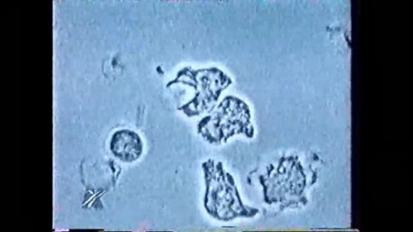 Что такое кровь?, Видео энциклопедия США, 80-90 годы