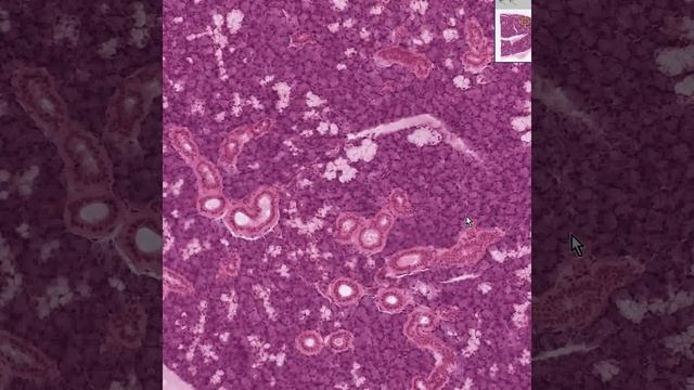 Shotgun Histology Submandibular Gland смотреть онлайн