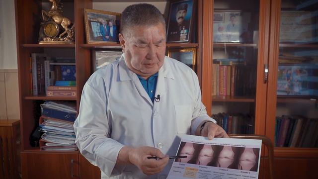 Муун оорууларынын келип чыгуу себептери смотреть онлайн