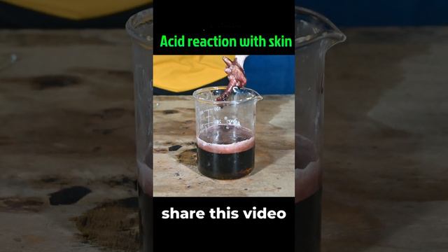 "The Horrifying Effects of Sulphuric Acid on Skin"@Madbadalphaodia смотреть онлайн