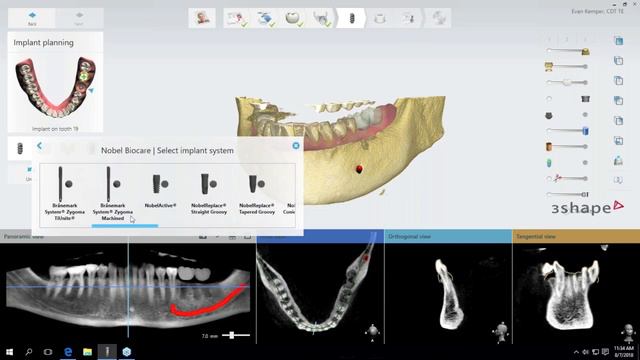 [Webinar] 3Shape Implant Studio 101: Introduction to 3Shape Implant Studio with Evan Kemper, RG, CD смотреть онлайн