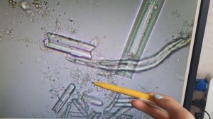 Микроскопия осадка мочи с нуля