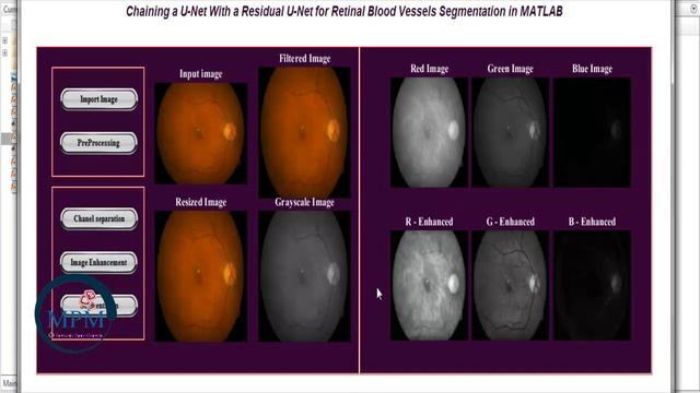 Chaining U Net with residual U Net for Retinal Blood Vessels Segmentation in Fundus Images - MATLAB смотреть онлайн