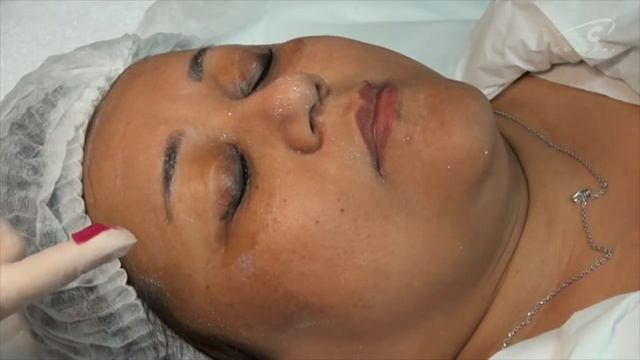 Пилинг для глаз - это терпимо смотреть онлайн