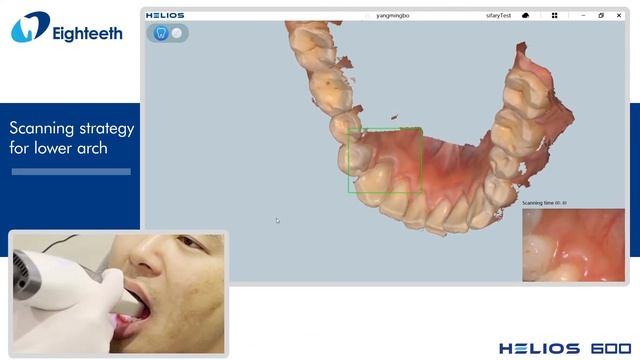Eighteeth Helios 600 Intraoral Scanner Scanning Strategy for Lower Arch смотреть онлайн