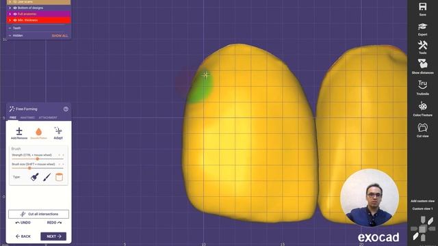 How to design laminate veneer with Exocad 3.1 Rijeka (part3) смотреть онлайн