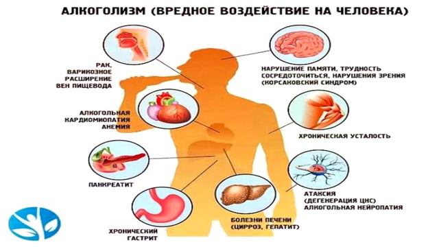 похмелье и его влияние на человека смотреть онлайн