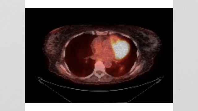 Intro, Staging, Lung Lecture смотреть онлайн