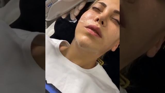 Smas-лифтинг в Краснодаре в студии Moon Beauty смотреть онлайн