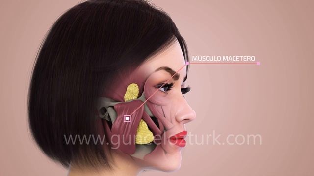 Bichectomia  (Extracción De Bolsa De La Mejilla) - Cómo Se Realiza La Operación? Guncel Ozturk M.D.