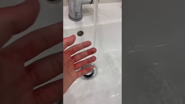 Что делать если обожглись свечей?? смотреть онлайн