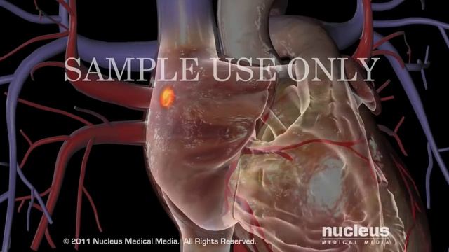Cardiac Conduction System смотреть онлайн