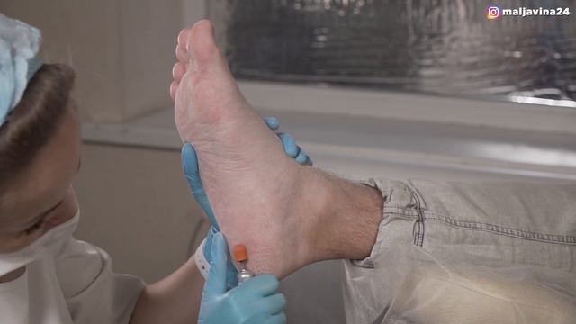 Обработка стопы. Аппаратный педикюр. Мастер класс. смотреть онлайн