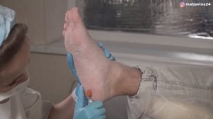 Обработка стопы. Аппаратный педикюр. Мастер класс.