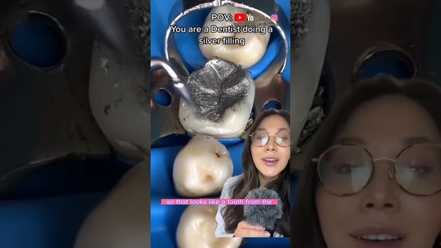 Dentist does a silver filling. #filling #cavity #silverfilling #dentist смотреть онлайн