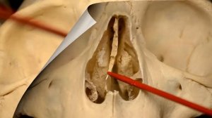 Решетчатая кость