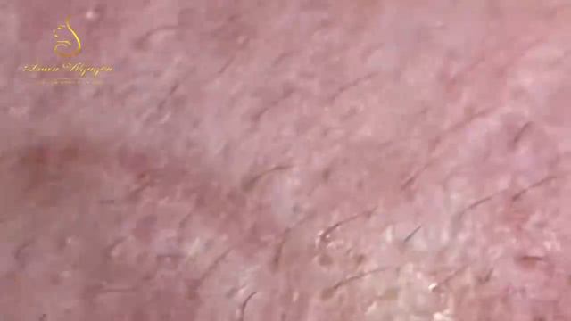 Relax Every Day With Loan Nguyen Spa TV #1048