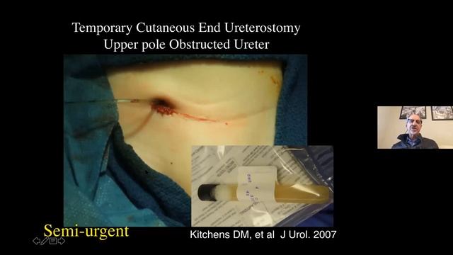 4.9.2020 Urology COViD Didactics - Pediatric Urologic Emergencies