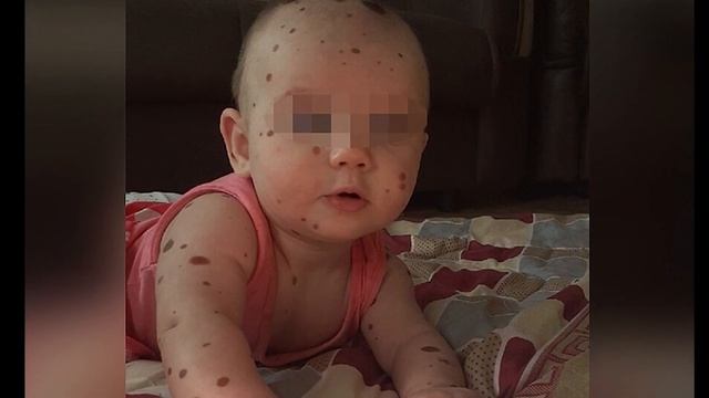 Курганский священник отказался крестить девочку с родимым пятном смотреть онлайн