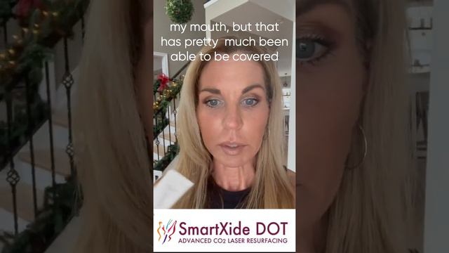 SmartXIDE DOT CO2 Laser Skin Resurfacing Day 7 Patient Live Video Journal RealSelfie Video.mov смотреть онлайн