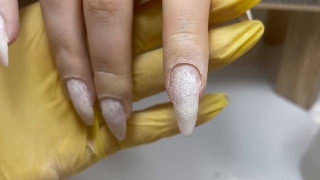 КЛЮВЫ-ГОРБУНЫ, поднимать или оставить так по желанию клиента? ВСЕГДА ОТСЛОЙКИ , что делать? смотреть онлайн