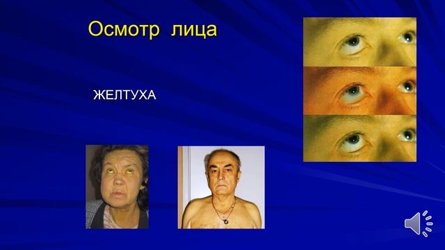 ПВБ. Общий осмотр. смотреть онлайн