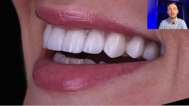 Пряма трансляція користувача Ярослав Казьо смотреть онлайн