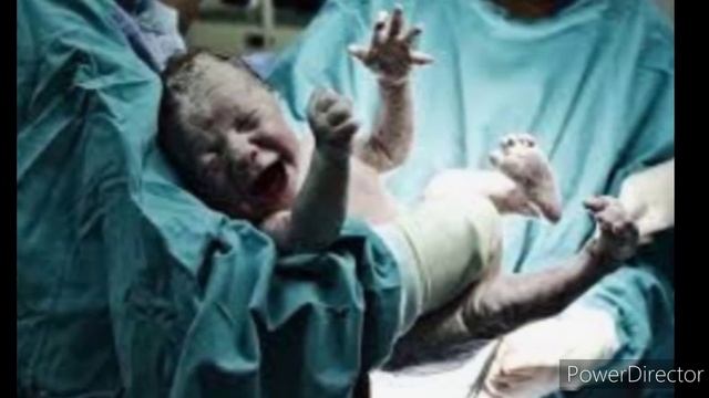 सपने में बच्चे को जन्म देते हुए देखना Sapne Me Bachhe Ka Janm Hote Dekhna Seeing Baby Birth In Drea