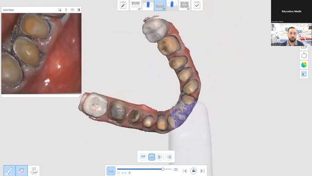 [Full ver.] Tricky Cases to Scan смотреть онлайн