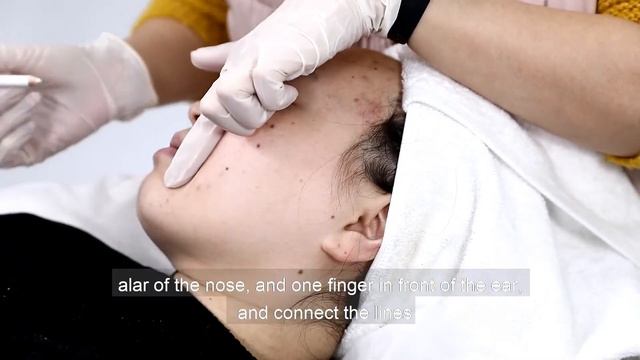 2 in 1 HIFU operation training video смотреть онлайн