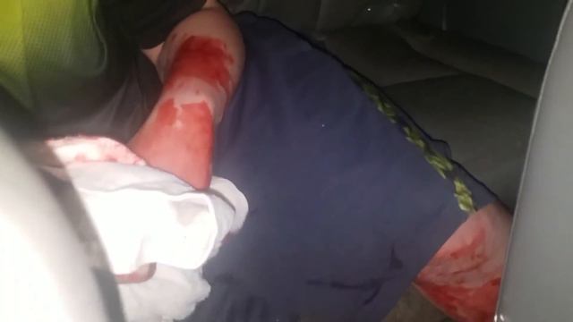 KID CUTS HIS FINGER OFF WITH CHAINSAW PRANK!!! смотреть онлайн
