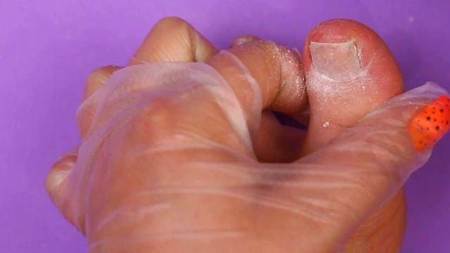 СУПЕР ПРЕОБРАЖЕНИЕ НОЖЕК ? Обработка стоп пилкой! Летний дизайн☀️ Самый лёгкий ГРАДИЕНТ! смотреть онлайн