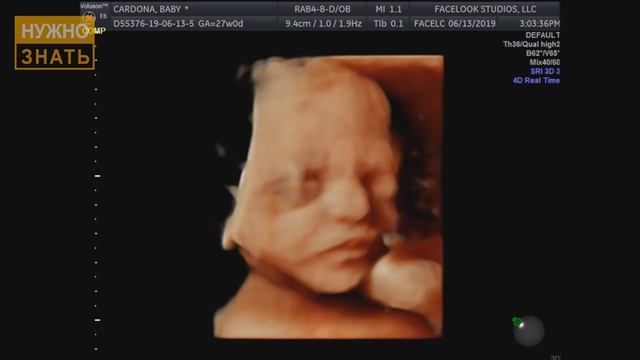 26 неделя беременности. Развитие плода. УЗИ в 3D и 4D Что чувствует беременная Как выглядит ребено смотреть онлайн