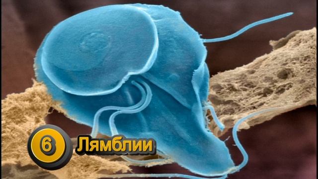 Паразиты живущие в теле человека смотреть онлайн