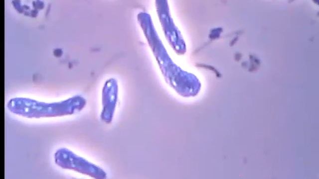 Жгутиконосцы | Flagellates смотреть онлайн