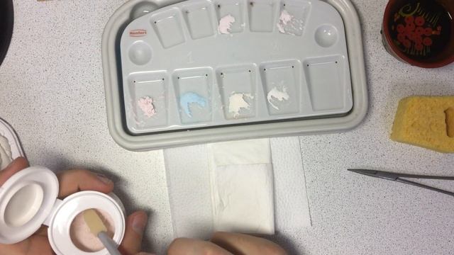 Поэтапное изготовление керамической коронки на импланте - изготовление зуба смотреть онлайн