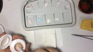 Поэтапное изготовление керамической коронки на импланте - изготовление зуба