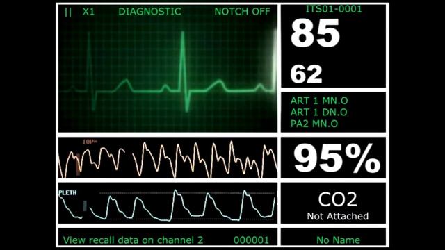 Hospital Monitor Flatline to Alive (HD) смотреть онлайн