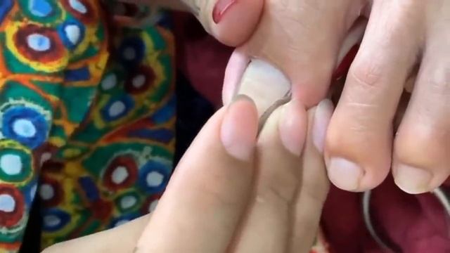 HOW TO CUT THICK TOENAILS - Toenail Cleaning Satisfying #22 смотреть онлайн